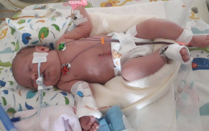 Zbiórka Mała Nadia czeka na pomoc - zdjęcie główne