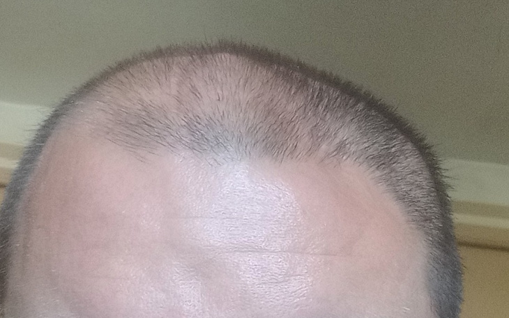 Zbiórka Na życie dla 2 dzieci - zdjęcie główne