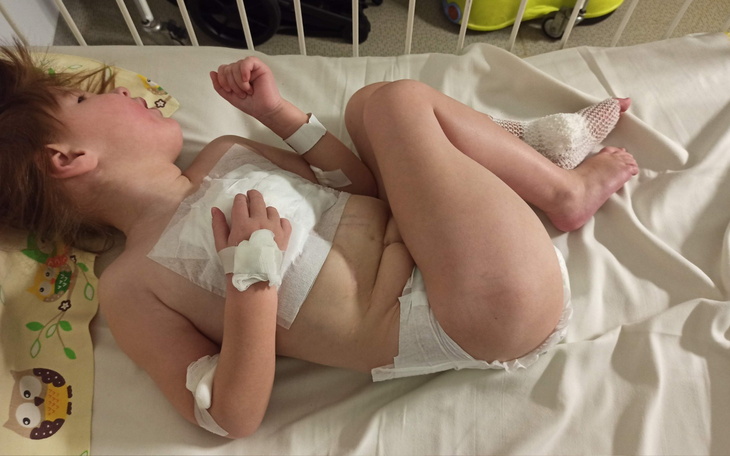 Dziecko leżące w szpitalu, z opatrunkami na ciele.