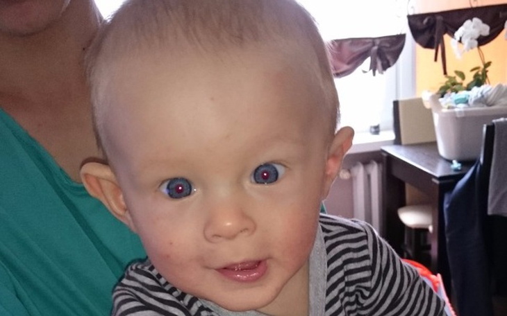 Zbiórka Leczenie kaskiem plagiocefalii - zdjęcie główne