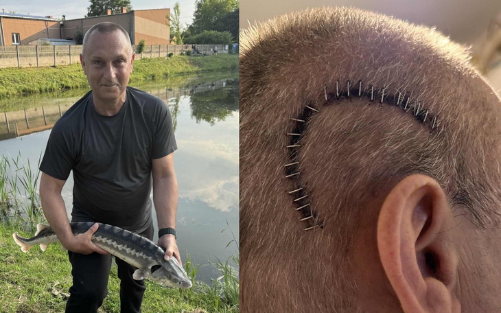 Mężczyzna trzymający rybę, z widoczną blizną na głowie.