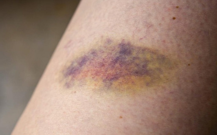 Zbiórka Ucieczka od oprawcy - zdjęcie główne