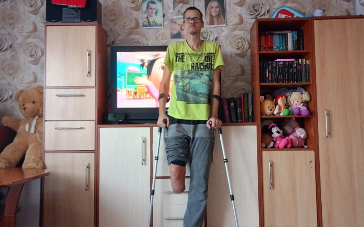 Mężczyzna z protezą nogi, stojący w pokoju z telewizorem w tle.