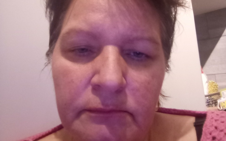 Zbiórka Pomoc na leczenie Anny - zdjęcie główne