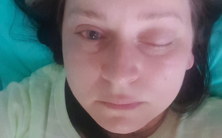 Zbiórka Pomóż mi wygrać z tetniakami - zdjęcie główne