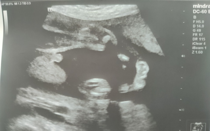 Zbiórka Narodziny dziecka .. - zdjęcie główne