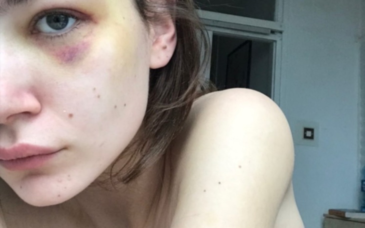 Zbiórka Przemoc - zdjęcie główne