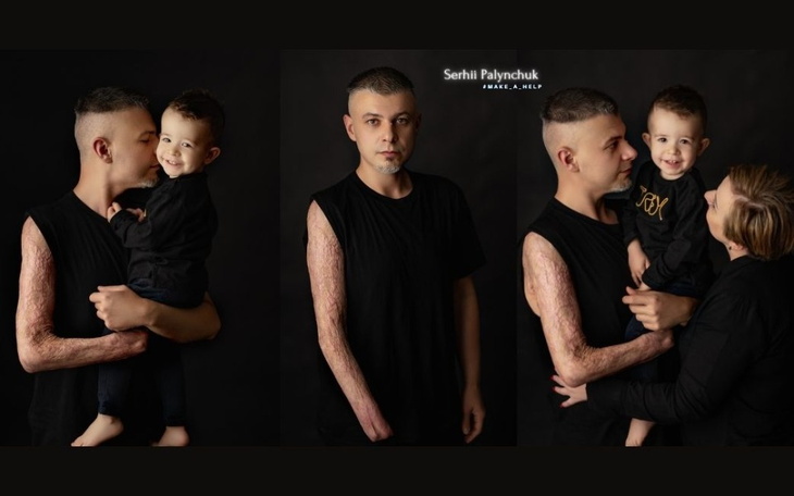 Zbiórka Pomóż zdobyć nową rękę... - zdjęcie główne