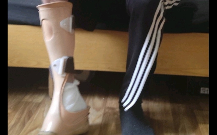 Zbiórka Dla Saszy - zdjęcie główne