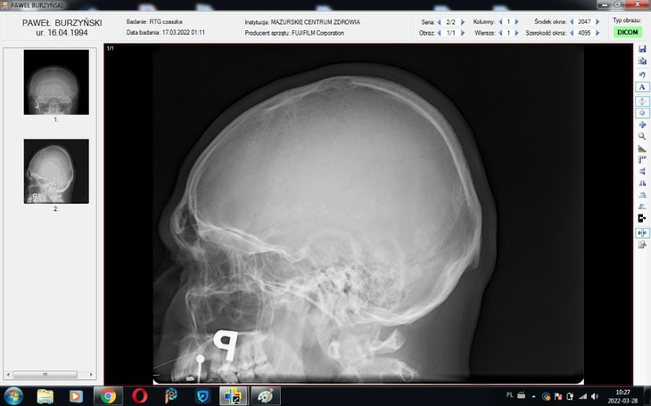 Zbiórka Sprzedam Poematy Na leczenie... - zdjęcie główne