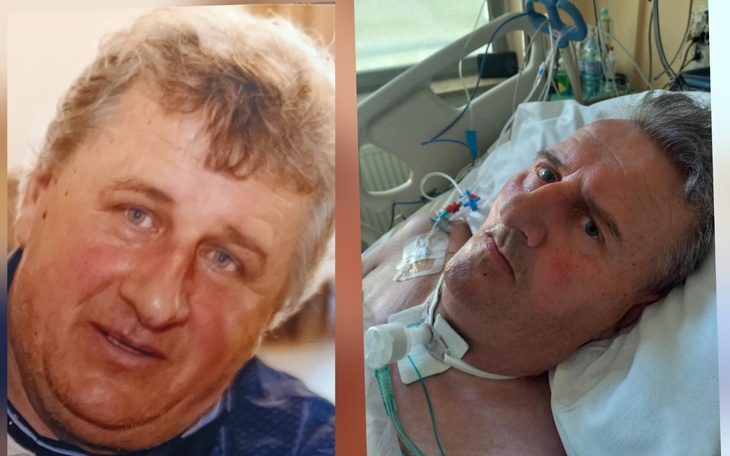 Porównanie zdjęć mężczyzny sprzed lat i obecnie w szpitalu.