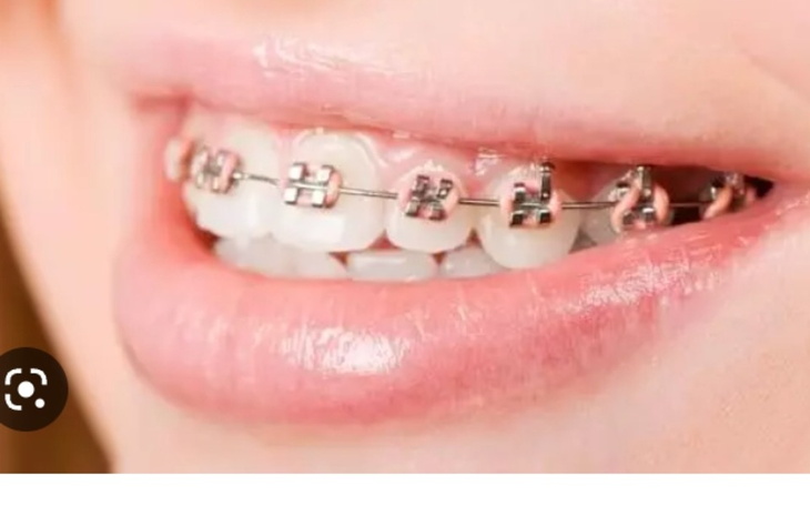 Zbiórka Z Beram z Dziewczynom na Apart - zdjęcie główne