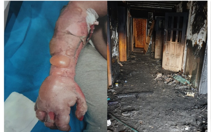 Zbiórka pożar wszystko strawił - zdjęcie główne