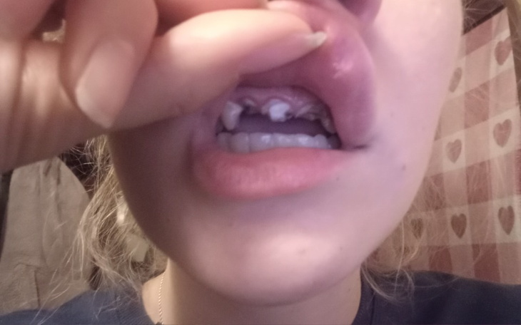 Zbiórka Na wstawienie zębów. 3 punkty - zdjęcie główne