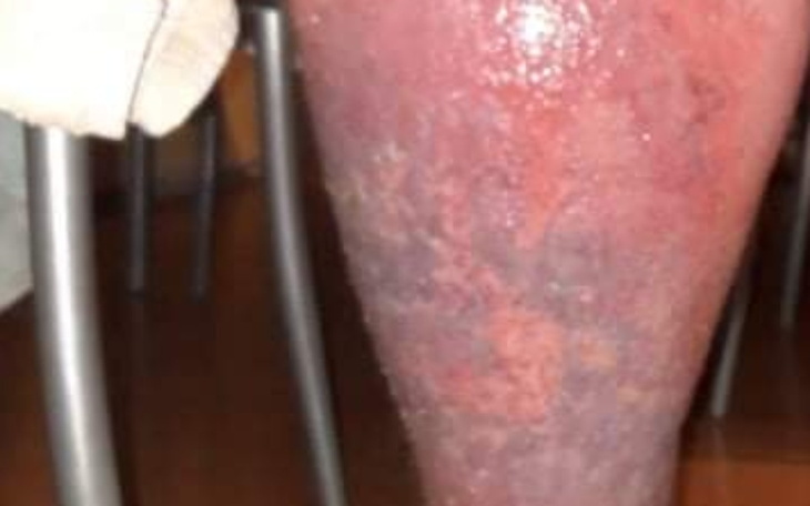 Zbiórka Na leczenie nóg i inne potrzeby - zdjęcie główne