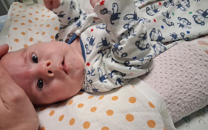 Noworodek leżący na poduszce, z wyrazem zdziwienia.