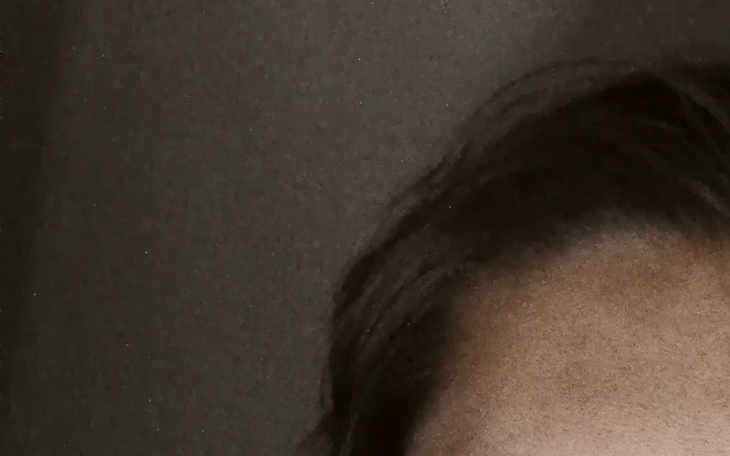 Zbiórka Zbieram na leki przeciwbólowe. - zdjęcie główne