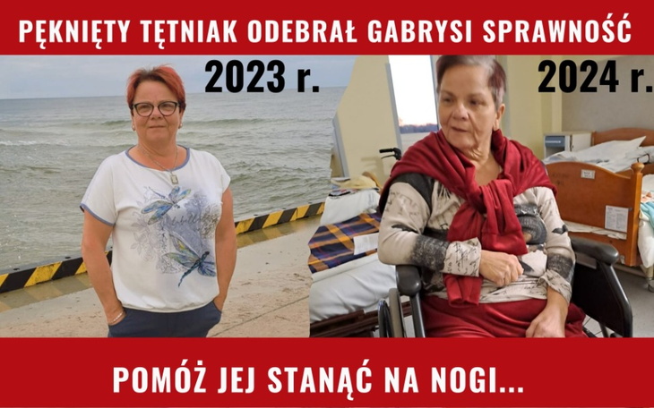 Balkony w starym budynku w czarno-białym.