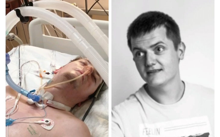 Mężczyzna w szpitalu z rurkami podłączonymi do ciała.