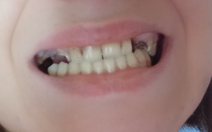 Zbiórka Życie ,chce żyć normalnie - zdjęcie główne