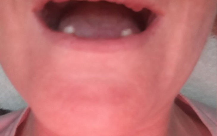 Zbiórka By móc się znowu uśmiechać - zdjęcie główne