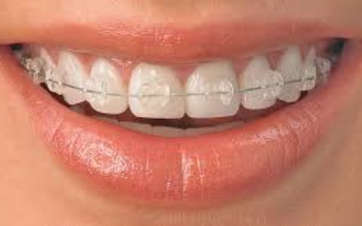 Zbiórka Na nowy uśmiech : ) - zdjęcie główne