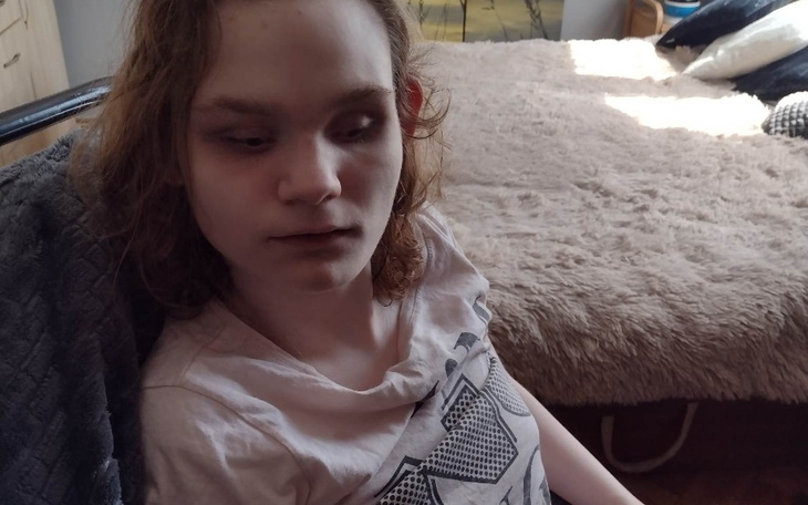 Zbiórka Na leczenie Amelki - zdjęcie główne