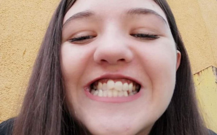 Zbiórka Ortodontyczny aparat dla Kamilii - zdjęcie główne