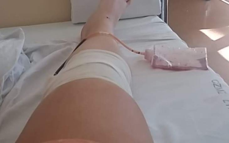 Zbiórka Pomoc dla kochanej przyjaciółki - zdjęcie główne