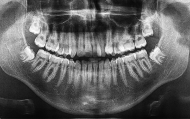 Zbiórka Aparaty ortodontyczne dla dzieci - zdjęcie główne
