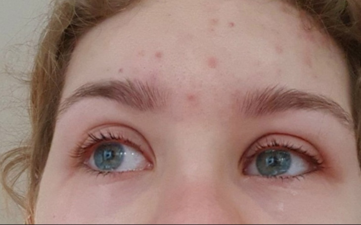 Zbiórka Moje zdrowie psychiczne - zdjęcie główne