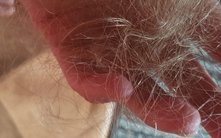 Zbiórka Ratuj moje włosy - zdjęcie główne