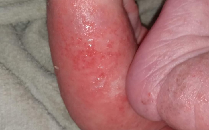 Zbiórka Oliwier walczy o zdrowie - zdjęcie główne