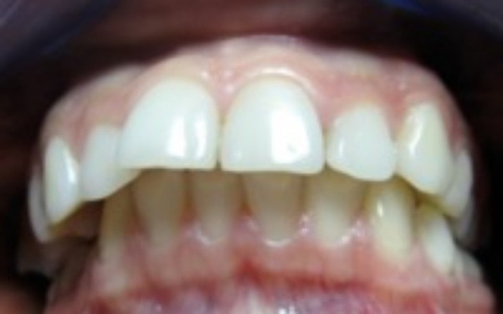 Zbiórka Zbieram na naprawę zebów ;( - zdjęcie główne