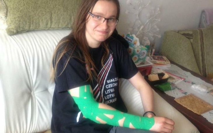 Młoda dziewczyna z unieruchomioną ręką w zielonym gipsie.