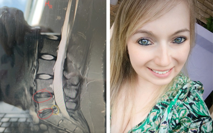 Zbiórka Mój kręgosłup potrzebuje pomocy. - zdjęcie główne