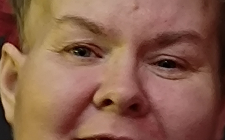 Zbiórka Rehabilitacja ręki i nogi - udar - zdjęcie główne