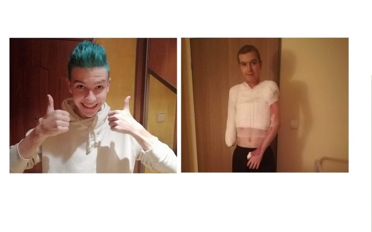 Zbiórka Pomóż Mi Samodzielnie Żyć - zdjęcie główne