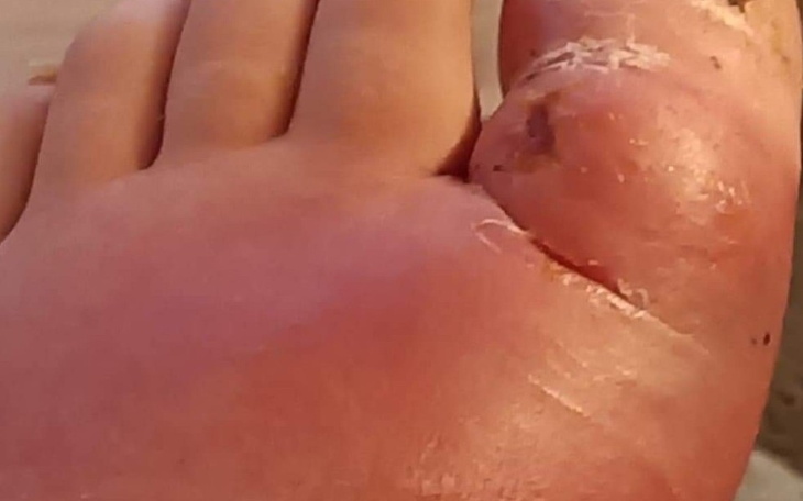 Zbiórka Leki. - zdjęcie główne