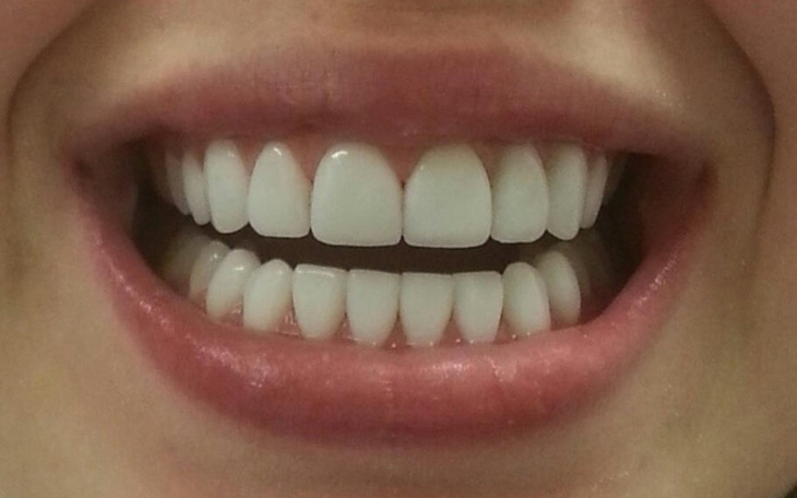 Zbiórka Nowe zęby nowe życie. - zdjęcie główne