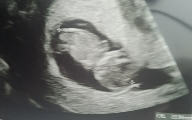 Zbiórka Pilna pomoc dla potrzebującej - zdjęcie główne