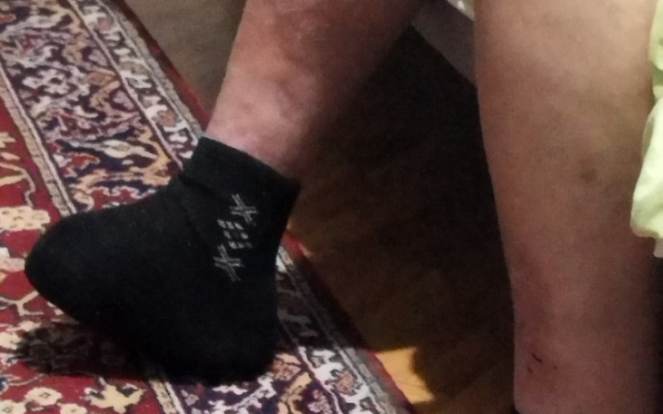 Zbiórka Pomoc choremu Bogdanowi - zdjęcie główne