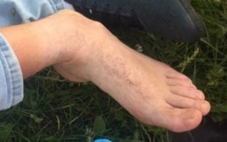 Zbiórka Na Rehabilitację i Opłaty - zdjęcie główne