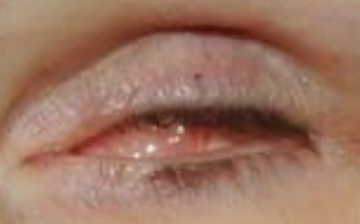 Zbiórka Na szklane oko - zdjęcie główne