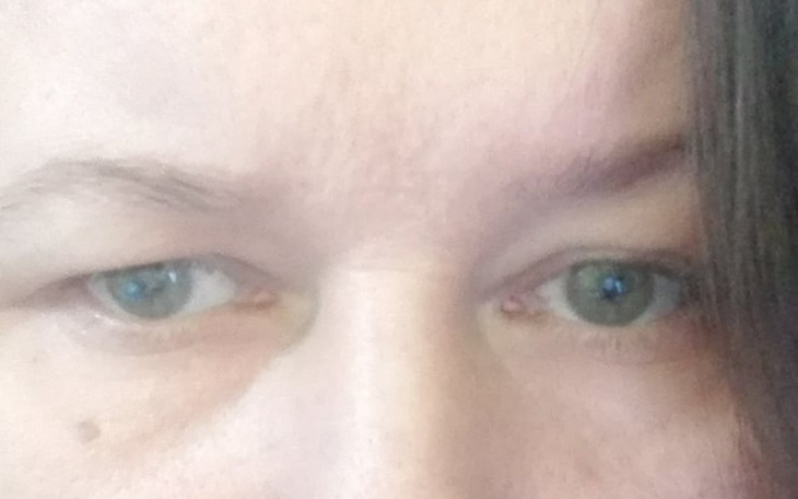 Zbiórka Pieniądze na operację zaćmy - zdjęcie główne