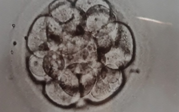 Zbiórka Dla Izy na in vitro - zdjęcie główne