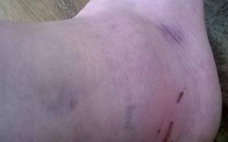 Zbiórka po wypadku i udarach - zdjęcie główne