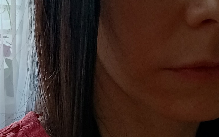 Zbiórka Na leczenie dziąseł i zębów - zdjęcie główne