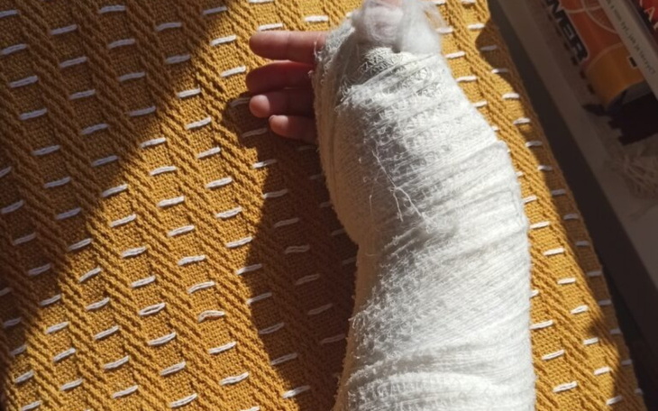 Zabandażowana ręka na tle żółtej tkaniny.