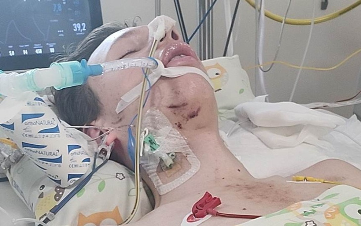 Młody mężczyzna w szpitalu, podłączony do aparatury medycznej.